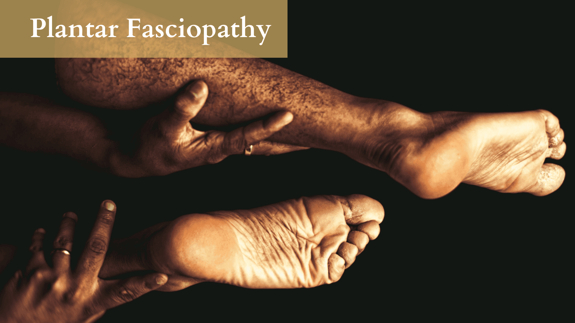 Plantar Fasciopathy