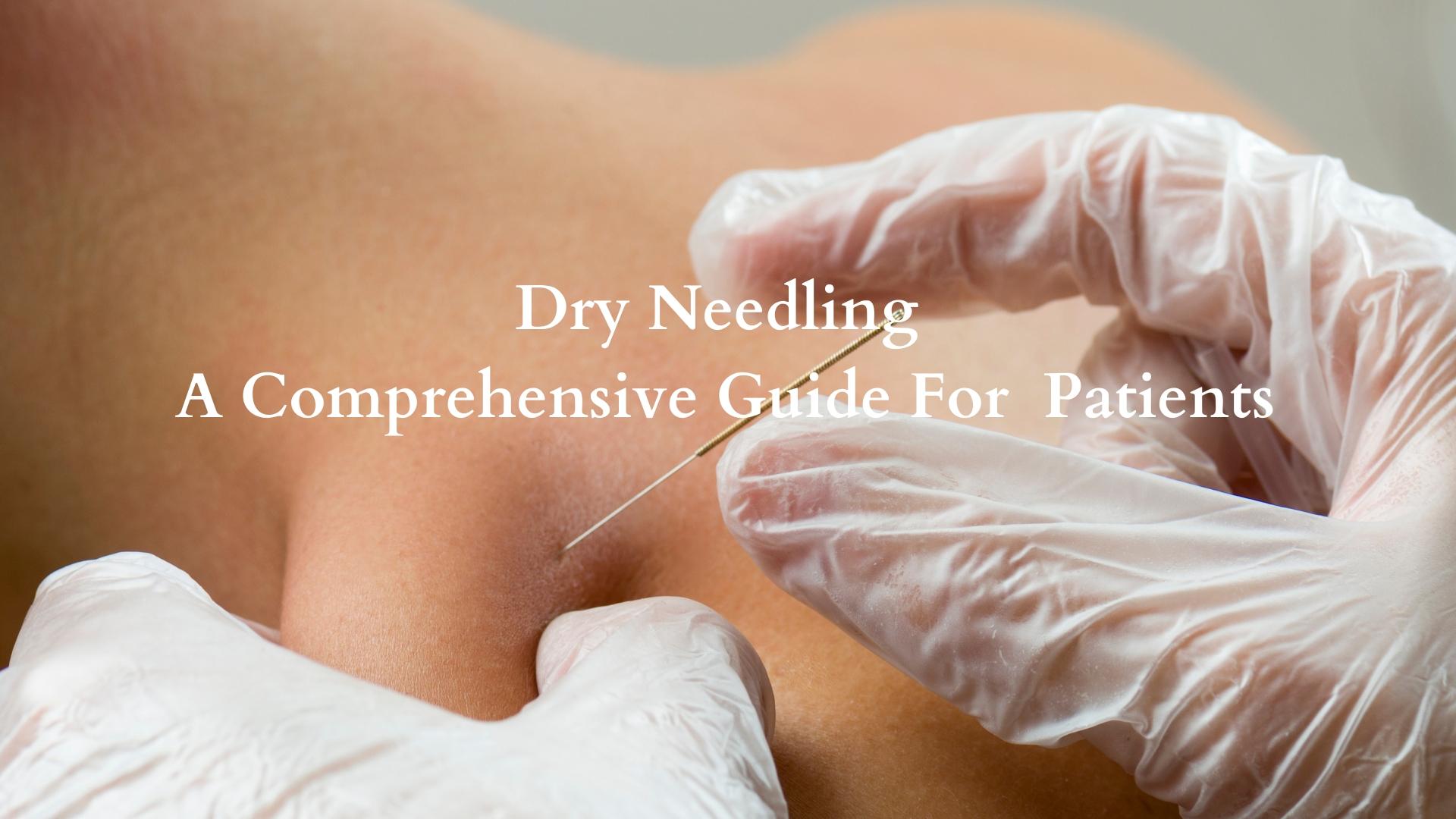 Dry Needling: A Comprehensive Guide For Patients