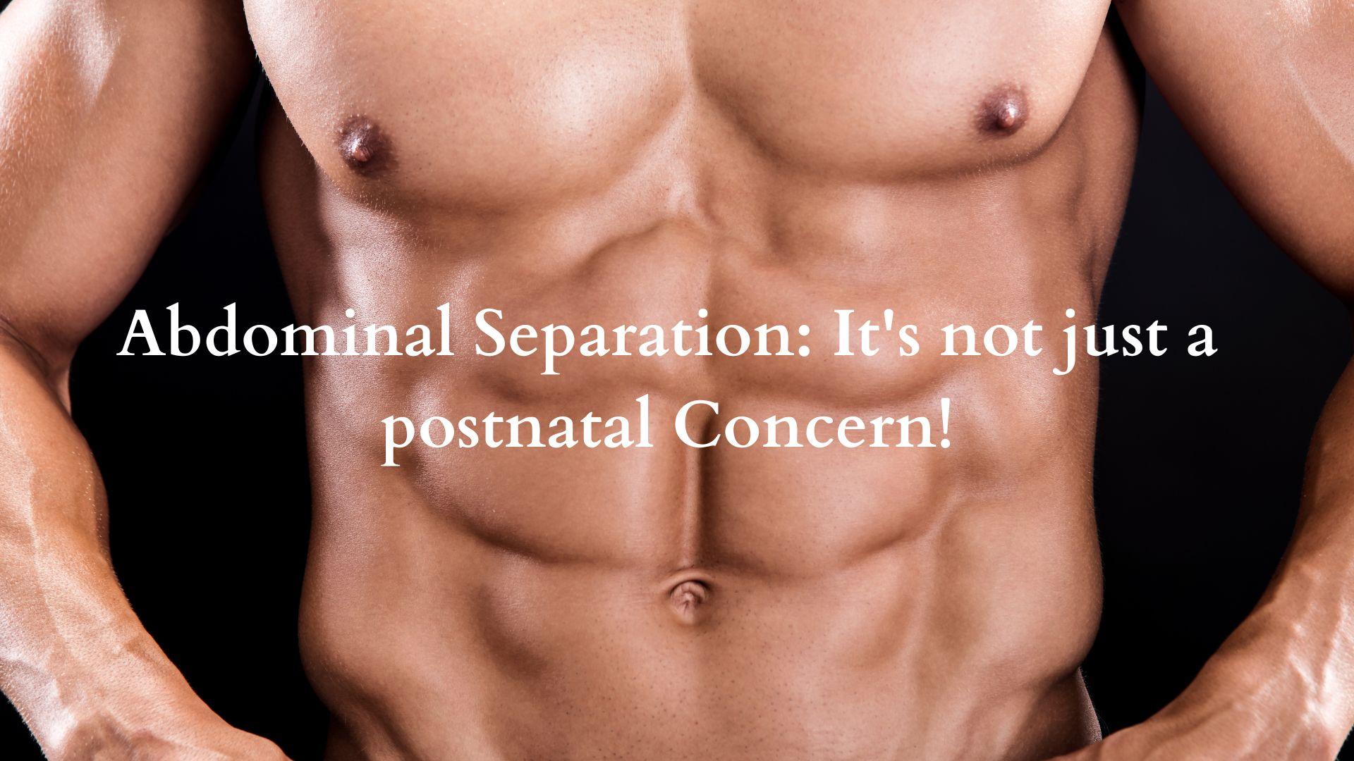 Abdominal Separation: It's Not Just a Postnatal Concern